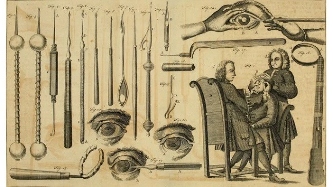 history of eye surgery