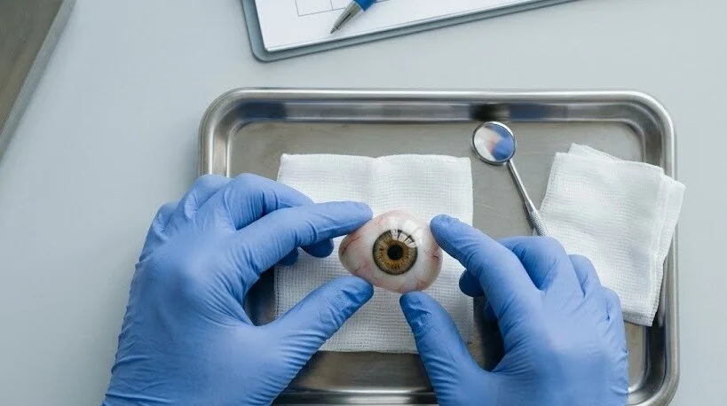 specialist inspecting prosthetic eye on examination tray - Artificial eye surgery -1